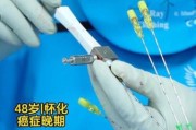 肿瘤治疗前景如何_最新突破有哪些