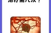 介入治疗适合哪些肿瘤_介入治疗能治愈癌症吗