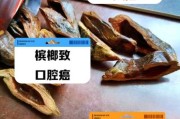 槟榔致癌是真的吗_槟榔行业未来还能走多远