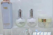 祛斑用什么产品最有效_祛斑后会不会反弹