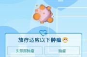 放射肿瘤前景如何_放射肿瘤治疗新技术有哪些