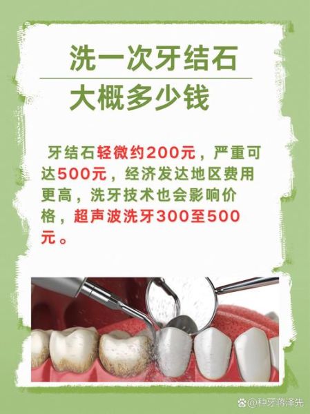 洗牙价格一般多少钱_洗牙对牙齿有伤害吗